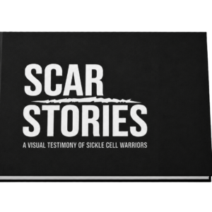 Scar Stories Book